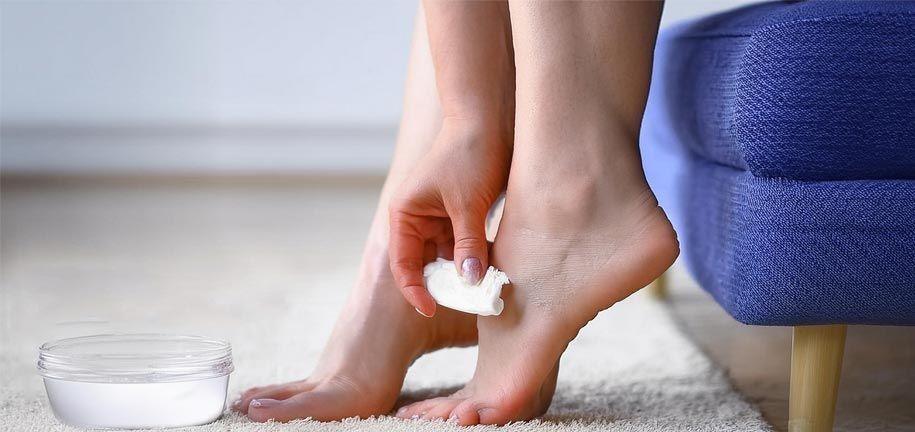 علاج تشققات الكعب