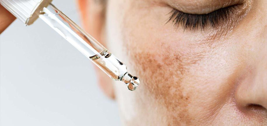 طرق فعالة لعلاج فرط التصبغ