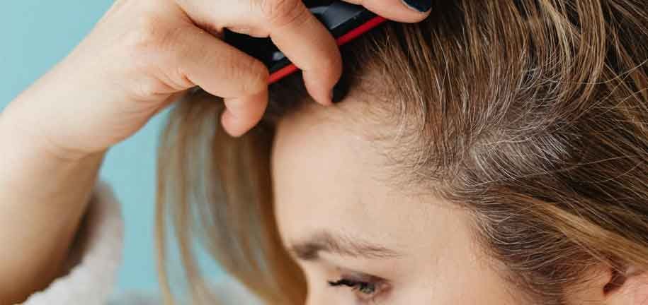 تخلص من قشرة الرأس