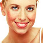 احمرار الجلد