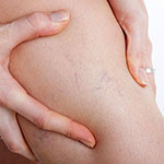 مستحضرات التجميل منشط الوريد